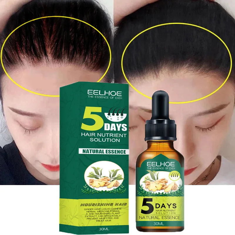 Anti Alopecia Fast Hair Growth Oil Ginger Essential Serum Hairless Baldhead Increase High Hairline Head Hair Essence Cream