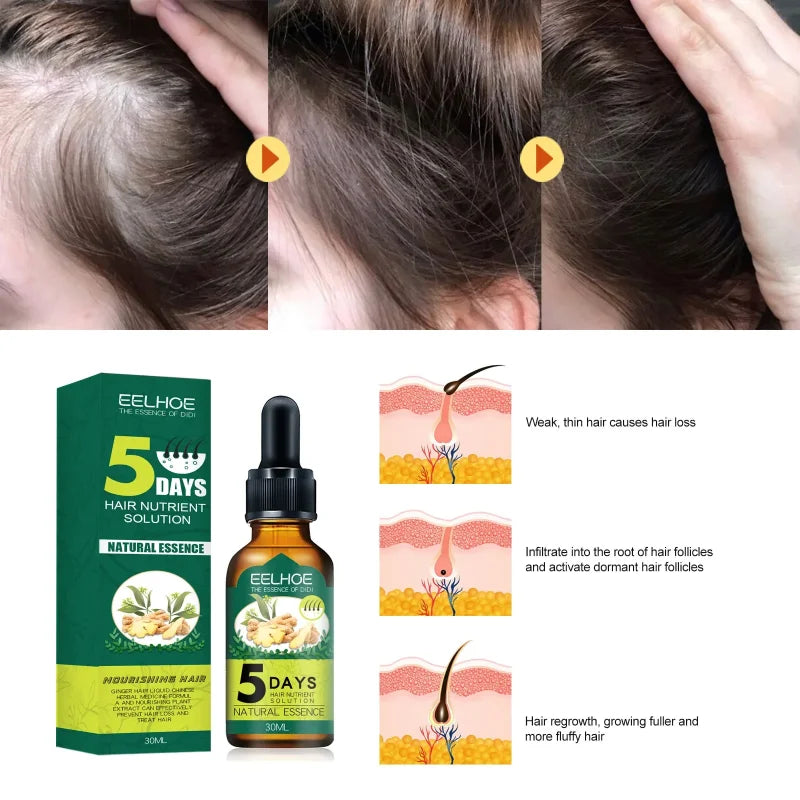Anti Alopecia Fast Hair Growth Oil Ginger Essential Serum Hairless Baldhead Increase High Hairline Head Hair Essence Cream